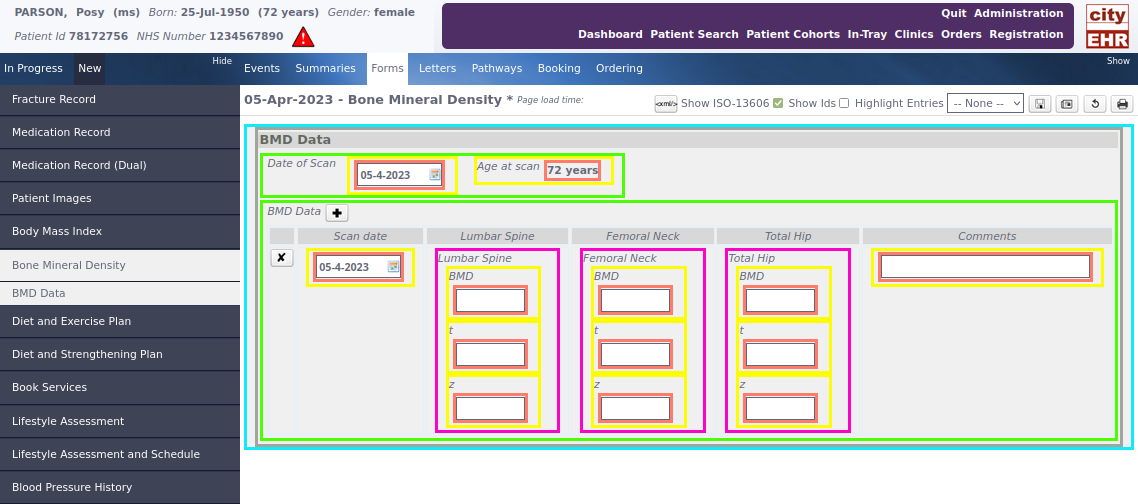 Showing ISO 13606 Structure in Debug Mode